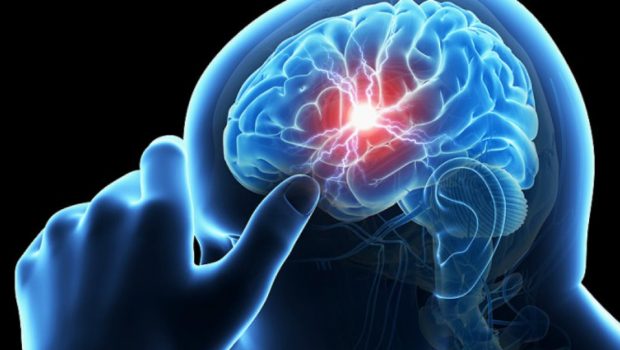 Εγκεφαλικό: Οι θάνατοι αναμένεται να φτάσουν τα πέντε εκατομμύρια ως το 2030