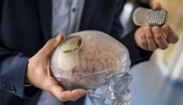 Η εταιρεία εγκεφαλικών εμφυτευμάτων (τσιπάκια) του Ελον Μασκ πήρε άδεια για πειράματα σε ανθρώπους 