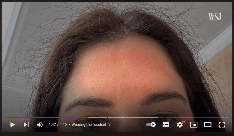 Γυναίκα που δοκίμασε το Apple Vision Pro για 30 λεπτά έμεινε με κοκκινίλες στο πρόσωπο