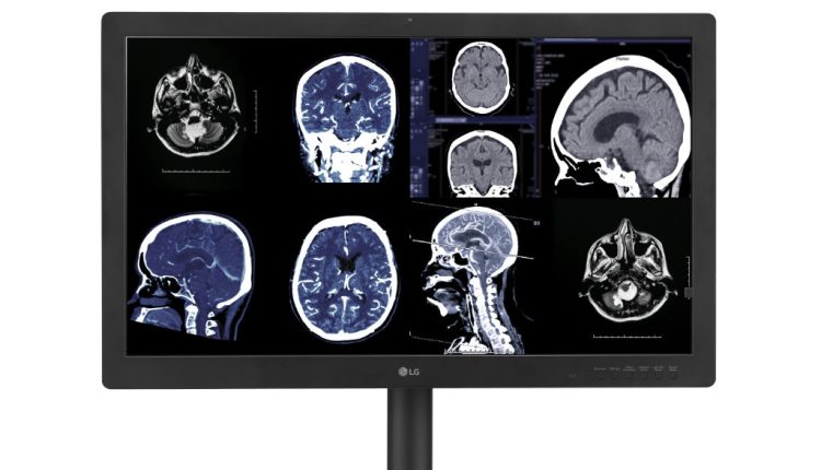 Η νέα διαγνωστική οθόνη της LG με τεχνολογία IPS Black παρέχει εγγυημένη ποιότητα εικόνας - Digitaltvinfo.gr