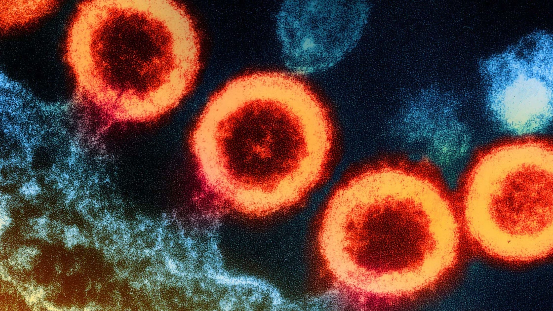 Ο ασθενής της Γενεύης είναι ο έκτος που θεραπεύτηκε από τον HIV