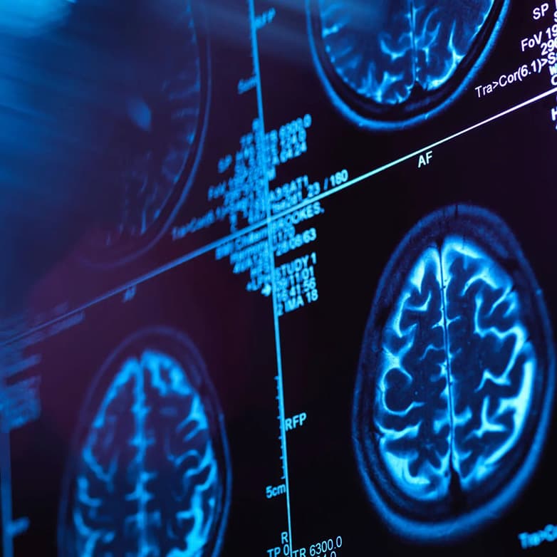 , Επιστήμονες αναπαρήγαγαν τραγούδι των Pink Floyd «ακούγοντας» τα εγκεφαλικά κύματα των ανθρώπων, TechWar.gr