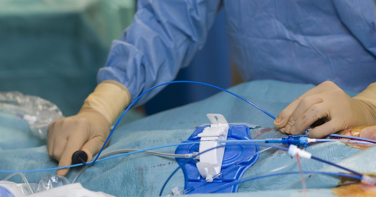 Η Johnson & Johnson λαμβάνει έγκριση από τον FDA για θεραπείες καρδιάς που δεν απαιτούν ακτινογραφίες