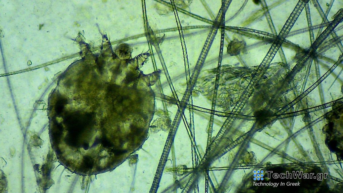 Έκρηξη λοιμώξεων από ψώρα χτυπά το Ηνωμένο Βασίλειο
