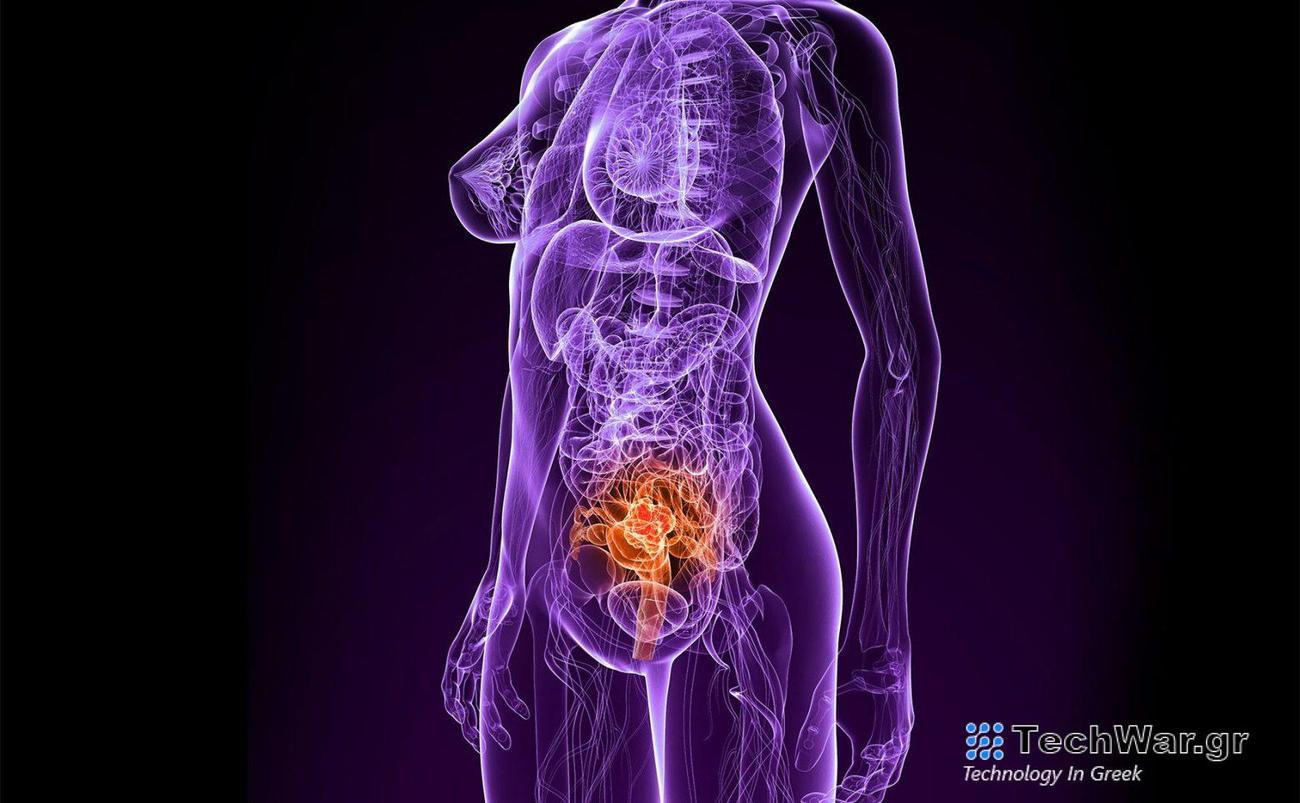 Σελφ τεστ για τον καρκίνο του τραχήλου